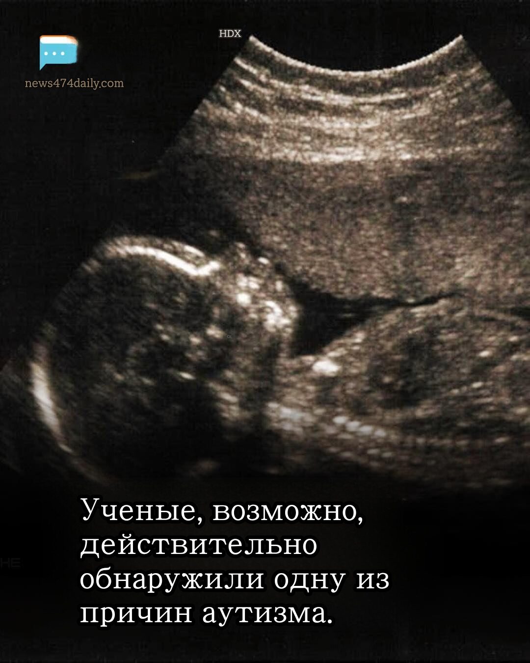 Недавние исследования подчеркнули важность микробиоты кишечника.
