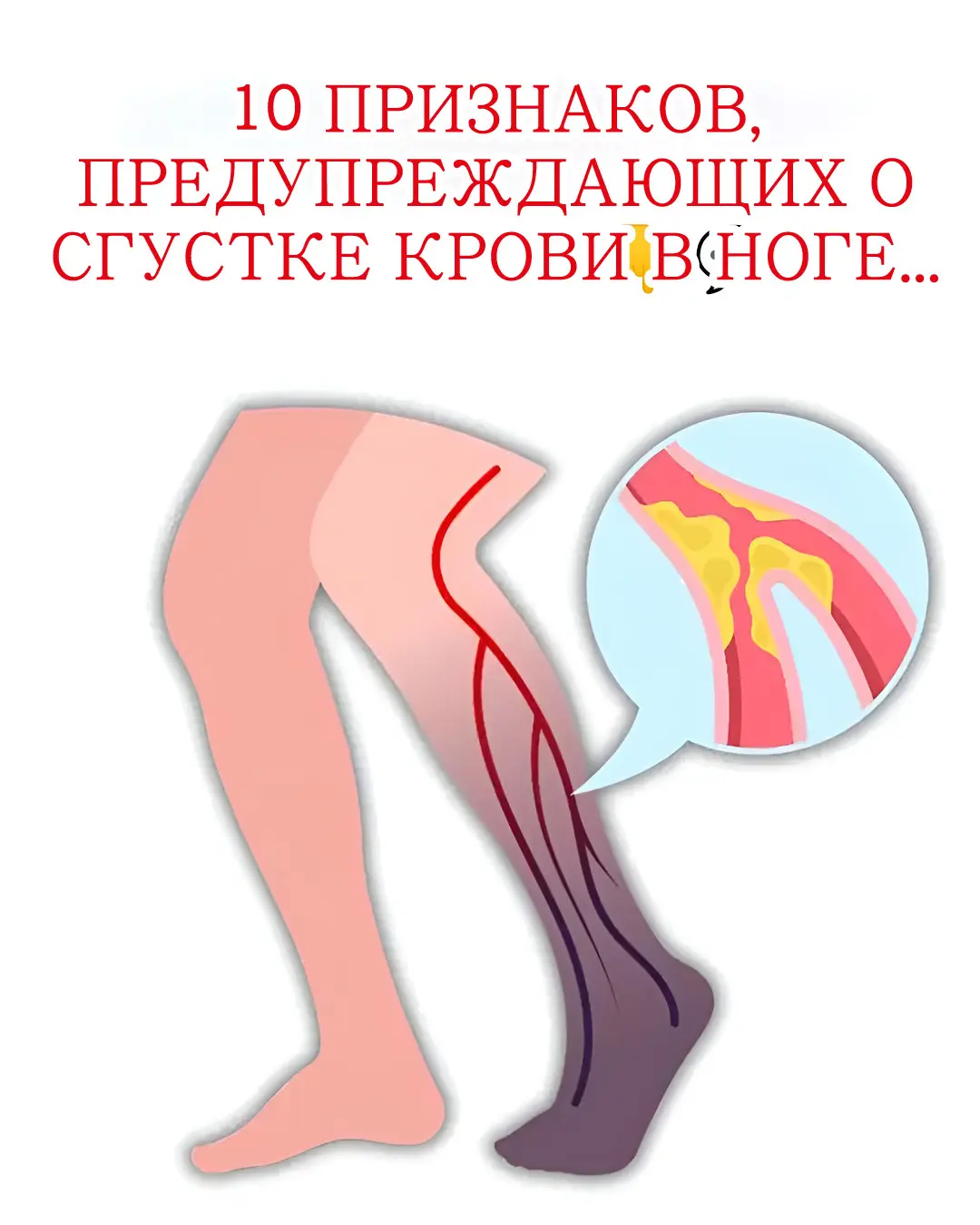 Немного опухшая лодыжка, видимое покраснение или временное ощущение жара…