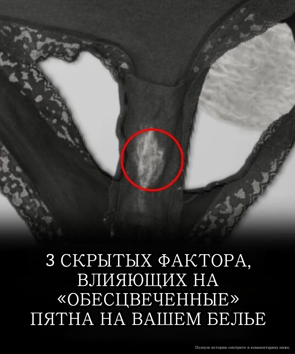 Заметили ли вы когда-нибудь выцветшее пятно, похожее на след от отбеливателя, в паховой области ваших тёмных трусов?