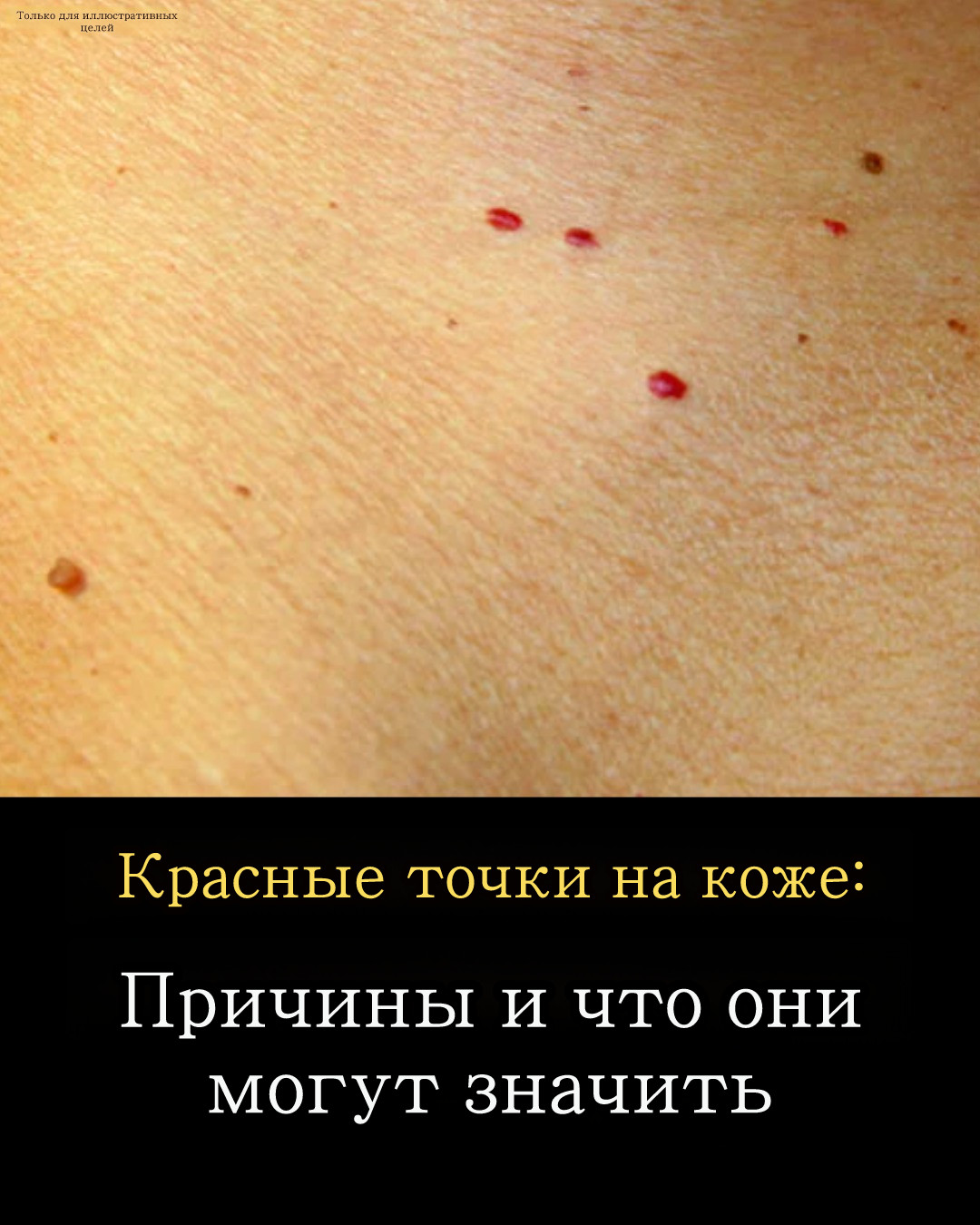 Красные пятна на коже имеют различные причины.