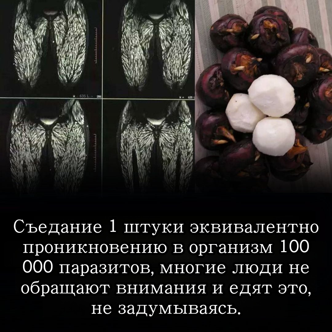 Паразиты, передающиеся через пищевые продукты, представляют значительную угрозу для безопасности пищевых продуктов.
