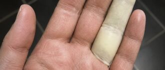 Почему близость без защиты может привести к проблемам со здоровьем