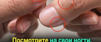 Какие сигналы о здоровье можно заметить по ногтям