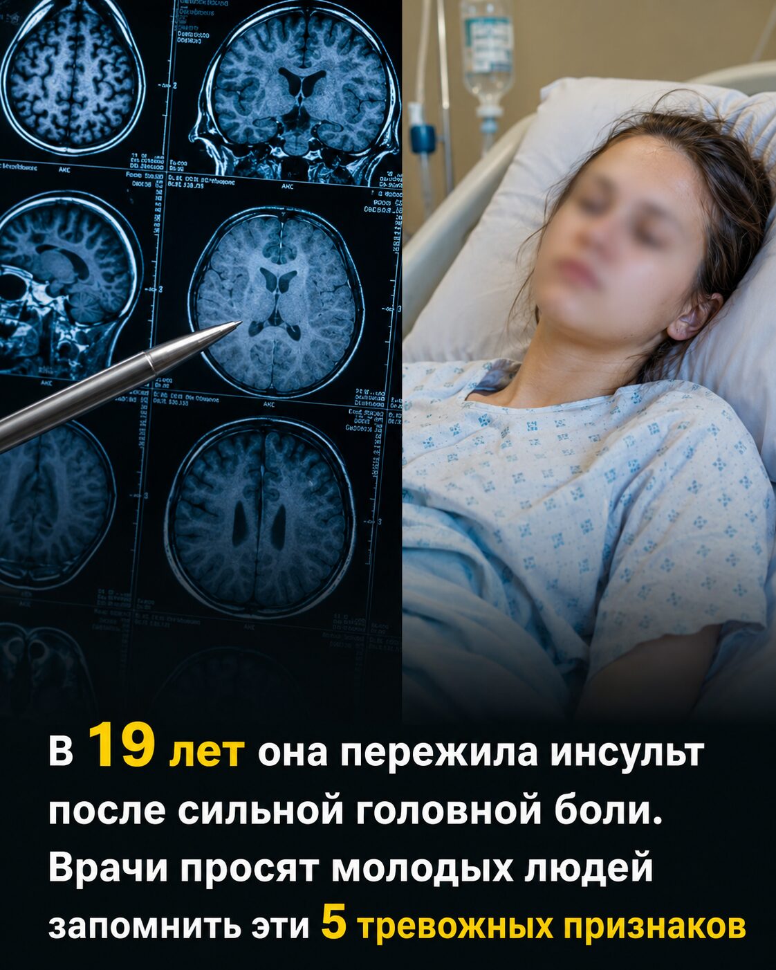 5 признаков инсульта, которые важно заметить вовремя