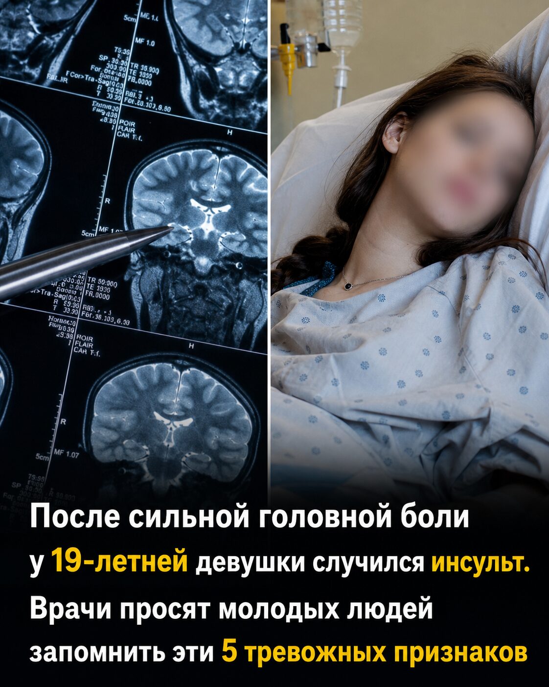 Инсульт в любом возрасте: 5 признаков, которые спасут жизнь