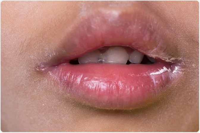 /html/body/article/div[1]/p[7]/img